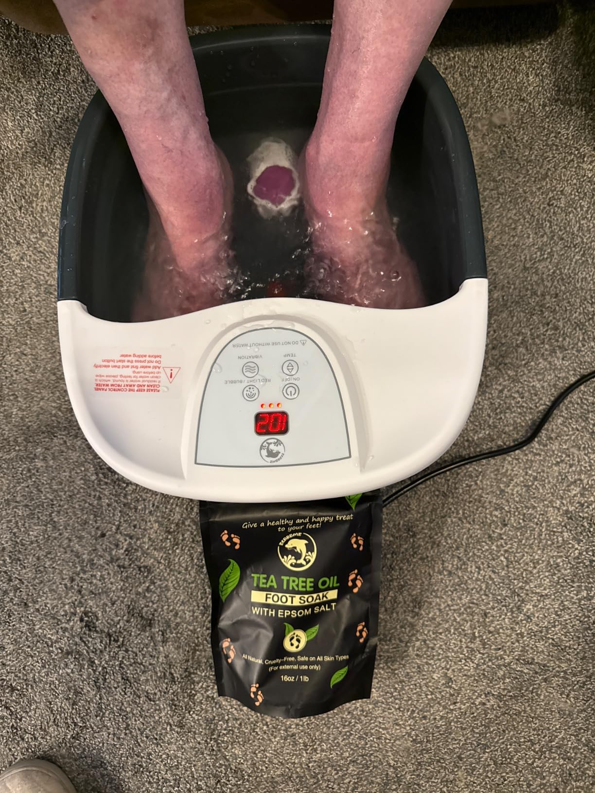 Foot Spa Bath Massager with Heat, Foot Soaking Tub with 22 Massage Rollers, Temperature Control, Jets, Bubbles, Epsom Salt and Vibration, Foot Bath soak tub for Relaxation - Grey customer photo 1