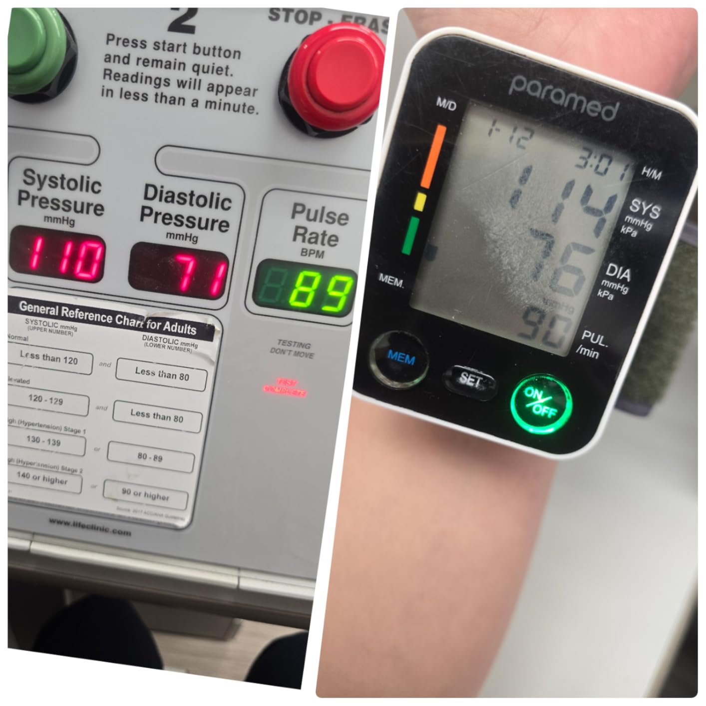 PARAMED Automatic Wrist Blood Pressure Monitor: Blood-Pressure Kit of Bp Cuff + 2AAA and Carrying case - Irregular Heartbeat Detector & 90 Readings Memory Function & Large Display customer photo 2