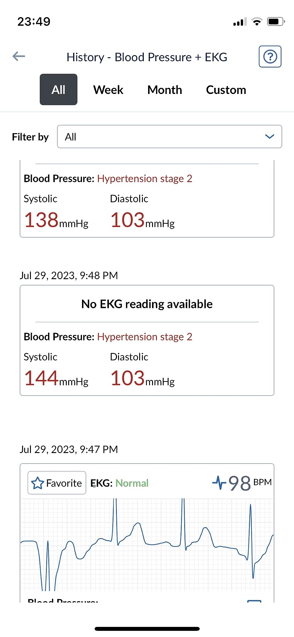 OMRON Complete 2-in-1 Blood Pressure Monitor + EKG for Home Use | Upper Arm Blood Pressure Cuff - Clinically Validated - Connect App customer photo 1