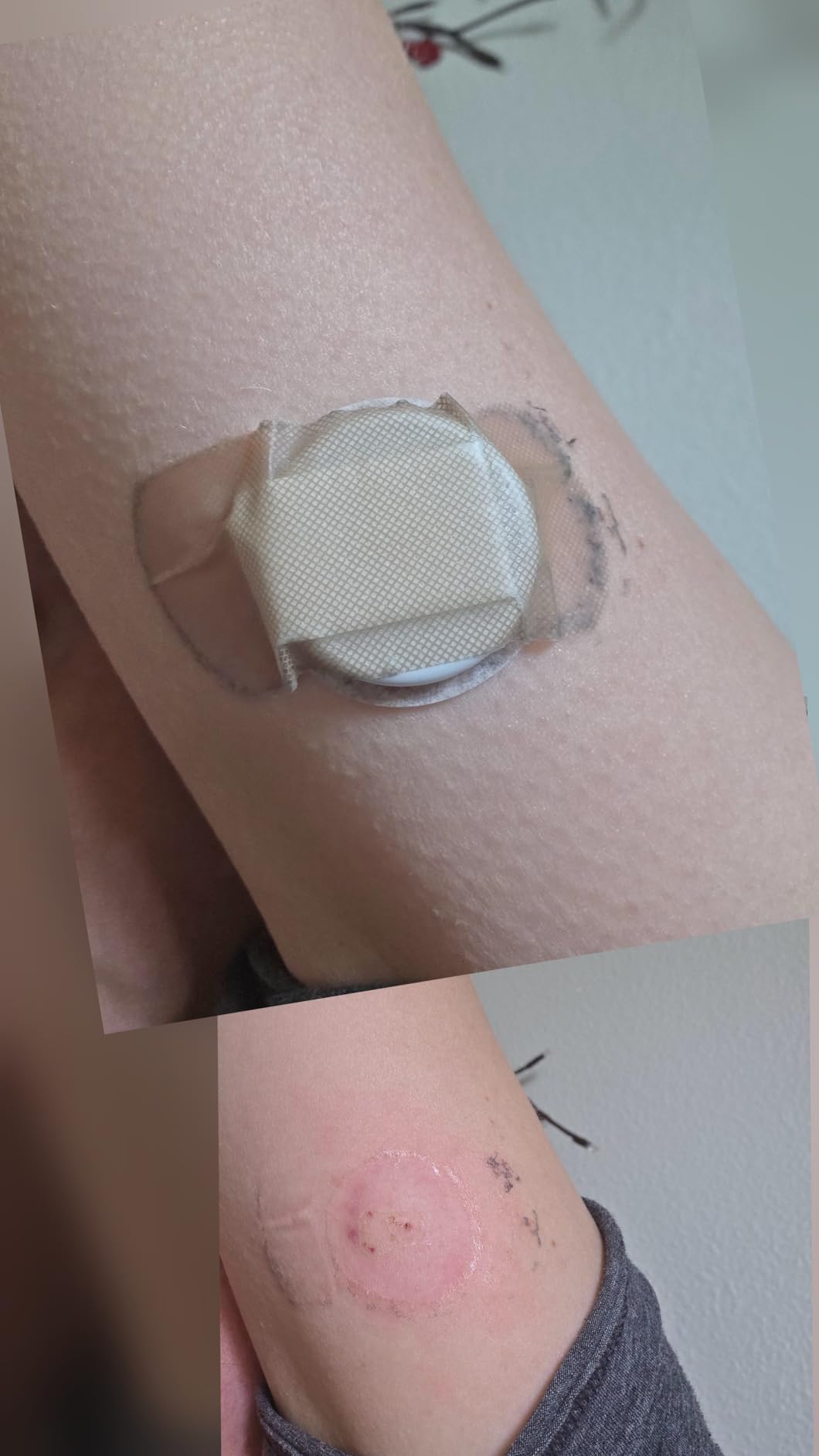 Lingo Continuous Glucose Monitor (CGM). 24/7 Glucose Tracking | By Abbott. Optimize Your Nutrition with Real-time Data & Insights. 1 biosensor lasts up to 14 days*. iOS & Android. US Only customer photo 1
