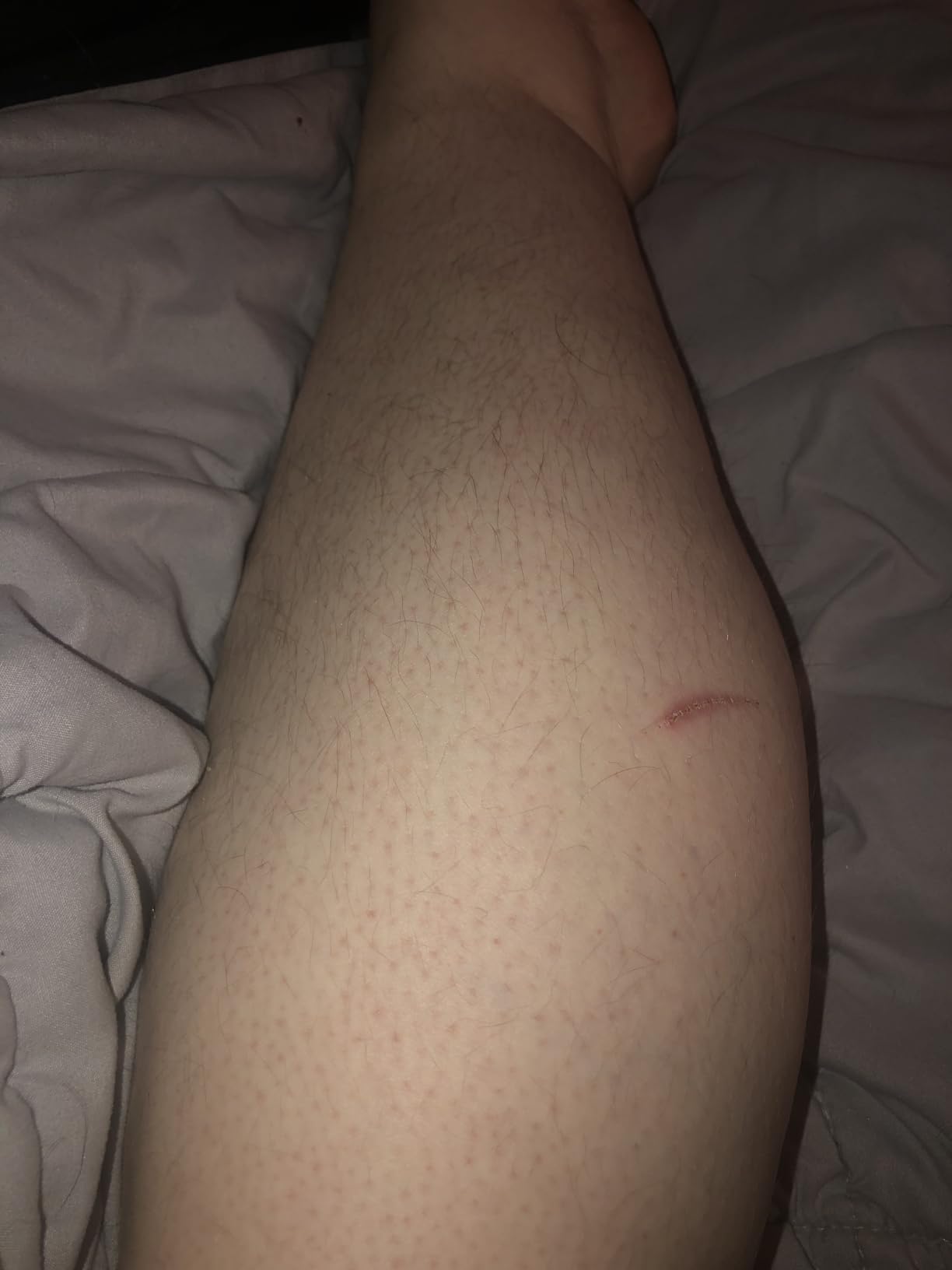 Philips SatinShave Essential Women’s Wet & Dry Electric Shaver for Legs & Body, Cordless, with Hypoallergenic Foil, HP6306/50 customer photo 1