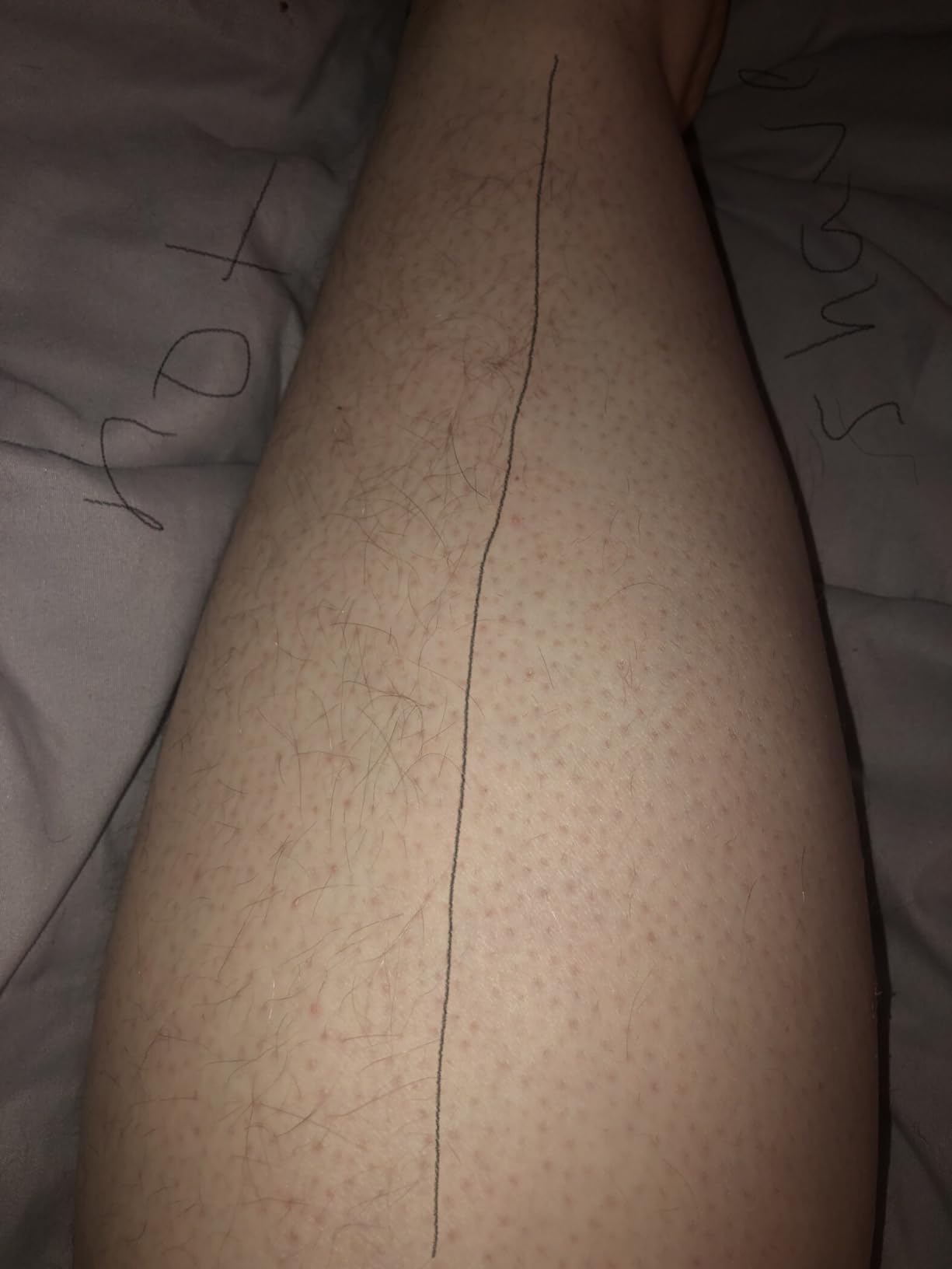 Philips SatinShave Essential Women’s Wet & Dry Electric Shaver for Legs & Body, Cordless, with Hypoallergenic Foil, HP6306/50 customer photo 2