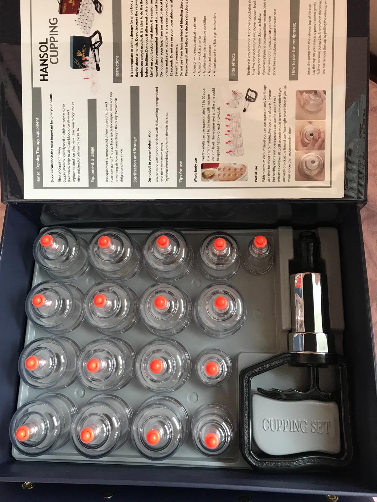 Hansol Cupping Therapy Equipment Set with Pumping Handle 17 Cups (Made in Korea) customer photo 1