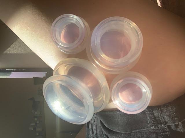 ELERA Silicone Cupping Therapy Set, Professionally Chinese Massage Cups for Cupping Therapy and Cellulite Reduction (7 Cups) customer photo 2