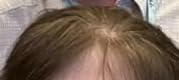 Clairol Root Touch Up Permanent Hair Dye, 5 Medium Brown, Pack of 1 customer photo 2