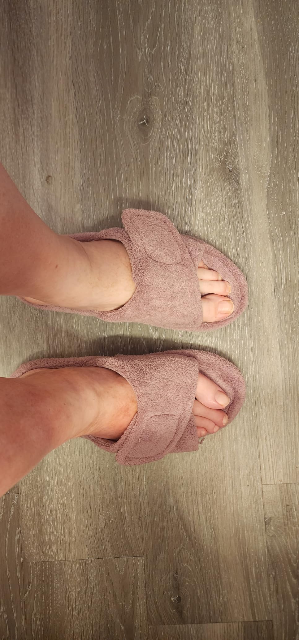 shevalues Orthopedic Slippers for Women with Arch Support Adjustable Open Toe House Shoes for Plantar Fasciitis customer photo 2